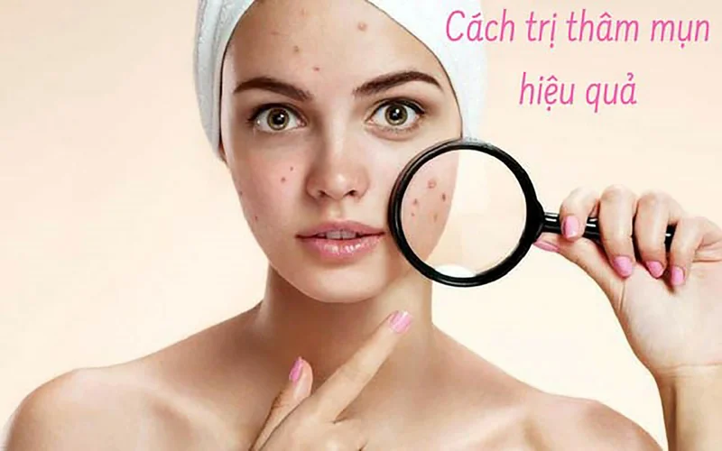 Sản phẩm trị thâm mụn Eucerin DermoPURIFYER Oil Control Skin Renewal Treatment