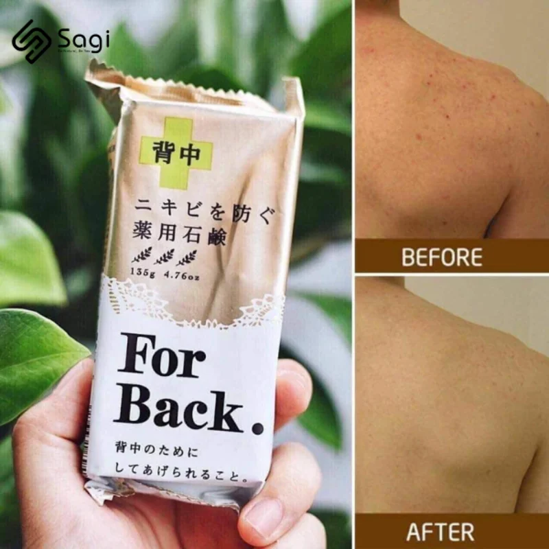 Kết hợp sử dụng xà phòng trị mụn lưng với các phương pháp khác để tăng hiệu quả