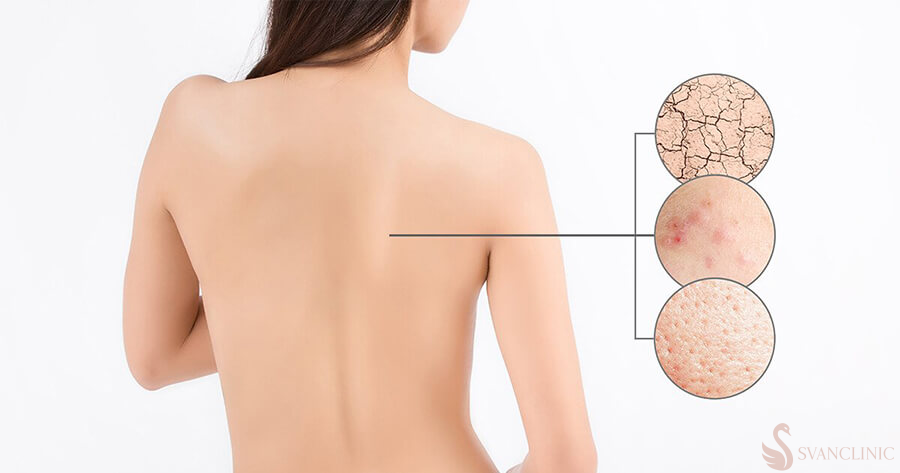 Cách thực hiện sử dụng tẩy tế bào chết body đúng cách