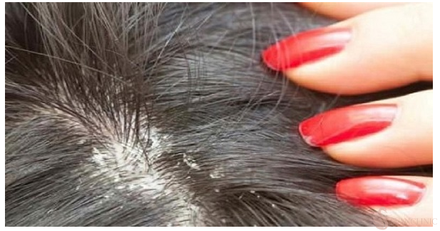 Thời điểm cần đi gặp các chuyên gia về vấn đề da đầu nhờn