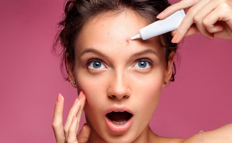 Quy trình sử dụng và những lưu ý quan trọng khi sử dụng kem trị mụn